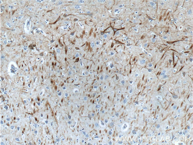 NF-L Antibody in Immunohistochemistry (Paraffin) (IHC (P))