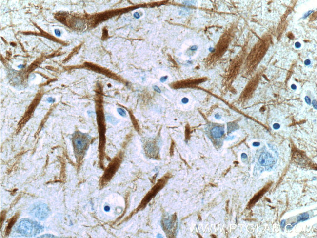 NF-L Antibody in Immunohistochemistry (Paraffin) (IHC (P))