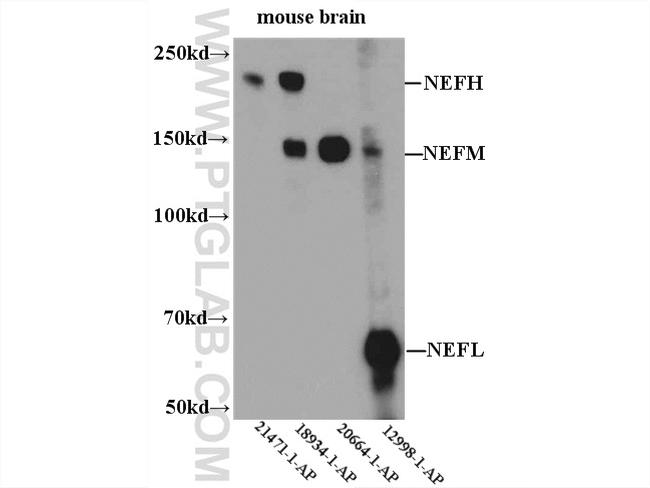 NF-L Antibody in Western Blot (WB)