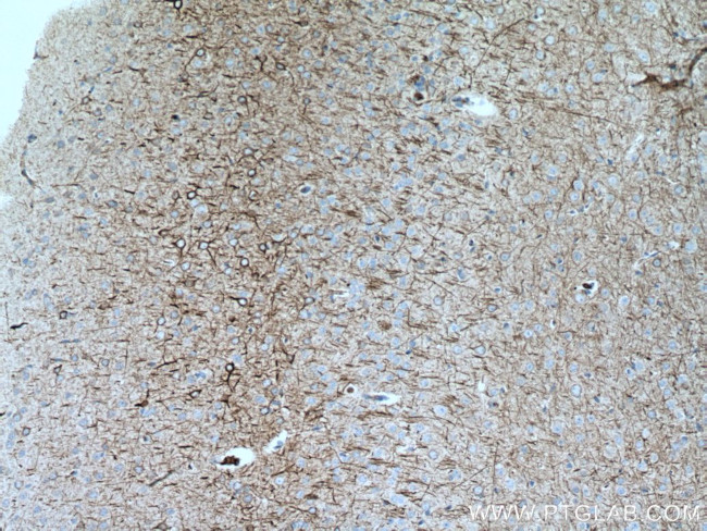 NF-L Antibody in Immunohistochemistry (Paraffin) (IHC (P))