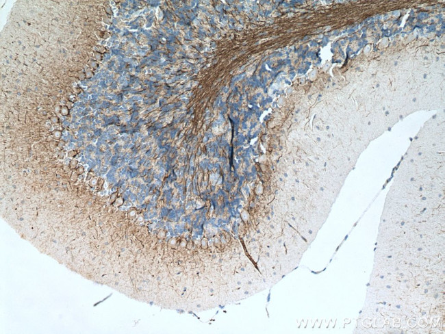 NF-L Antibody in Immunohistochemistry (Paraffin) (IHC (P))