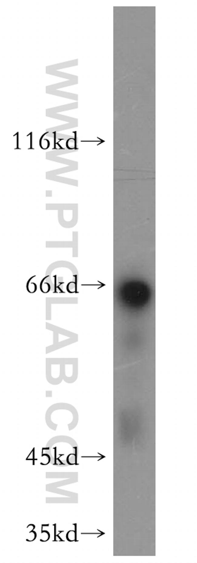 NF-L Antibody in Western Blot (WB)