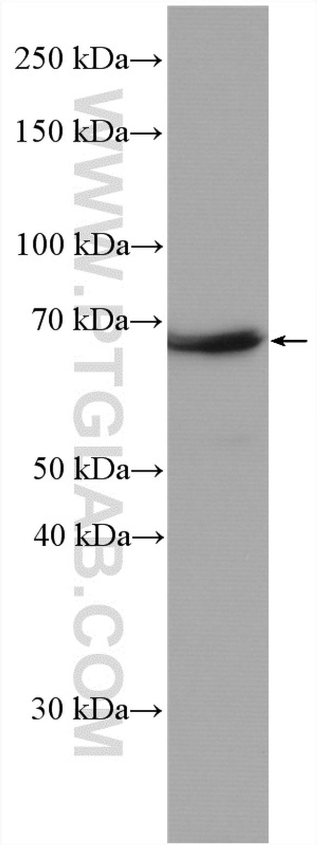 NF-L Antibody in Western Blot (WB)