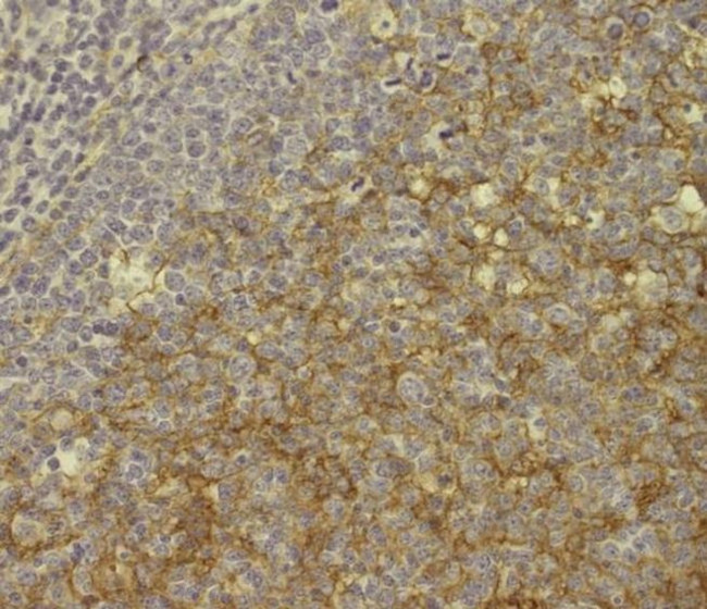 CD11b Antibody in Immunohistochemistry (Paraffin) (IHC (P))