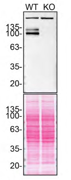 Amyloid Precursor Protein Antibody in Western Blot (WB)