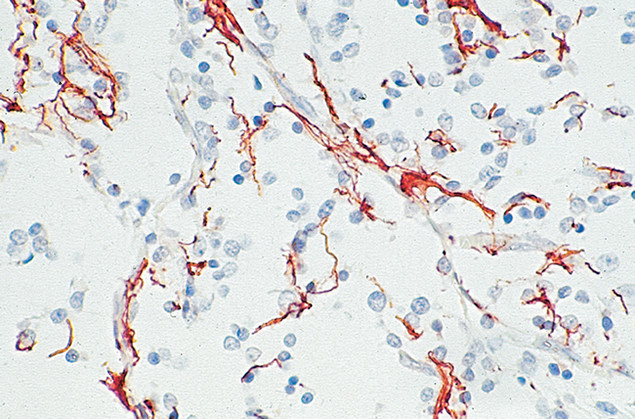 GFAP Antibody in Immunohistochemistry (IHC)