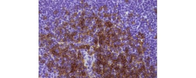 CD8a Antibody in Immunohistochemistry (Paraffin) (IHC (P))