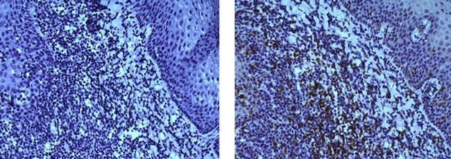 Mouse IgG (H+L) Secondary Antibody in Immunohistochemistry (Paraffin) (IHC (P))