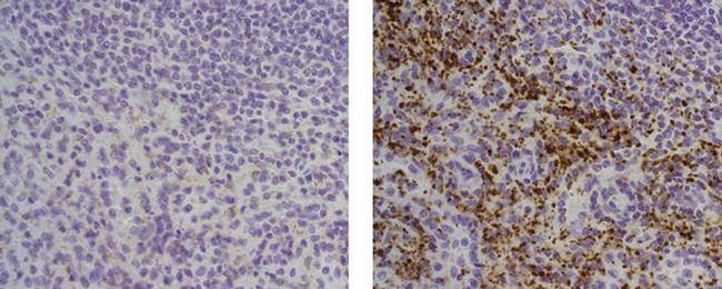 Mouse IgG (H+L) Secondary Antibody in Immunohistochemistry (Paraffin) (IHC (P))