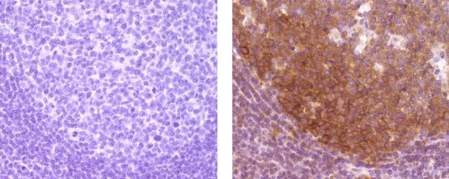 Mouse IgG (H+L) Secondary Antibody in Immunohistochemistry (Paraffin) (IHC (P))