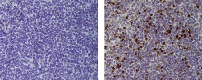 Mouse IgG (H+L) Secondary Antibody in Immunohistochemistry (Paraffin) (IHC (P))