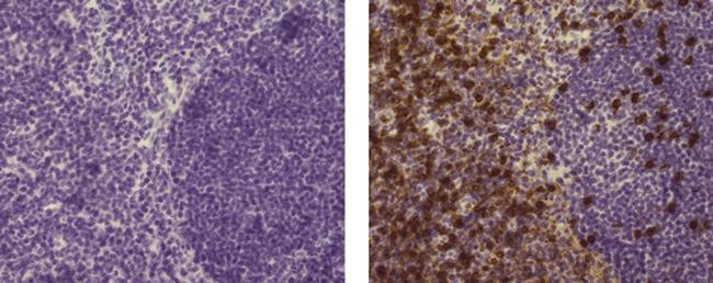 Mouse IgG (H+L) Secondary Antibody in Immunohistochemistry (Paraffin) (IHC (P))