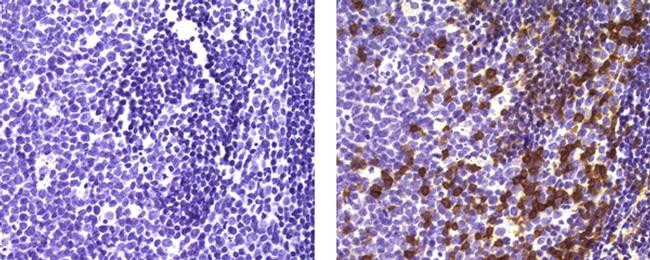 Mouse IgG (H+L) Secondary Antibody in Immunohistochemistry (Paraffin) (IHC (P))