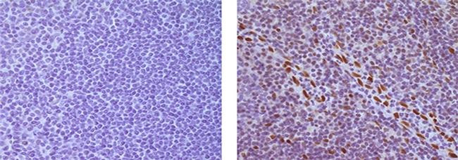 Mouse IgG (H+L) Secondary Antibody in Immunohistochemistry (Paraffin) (IHC (P))