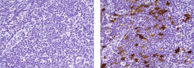 Mouse IgG (H+L) Secondary Antibody in Immunohistochemistry (Paraffin) (IHC (P))