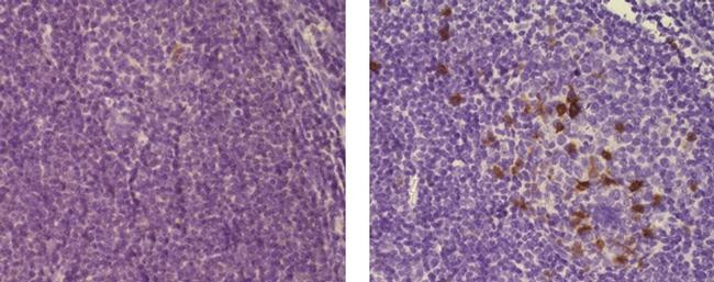 Mouse IgG (H+L) Secondary Antibody in Immunohistochemistry (Paraffin) (IHC (P))