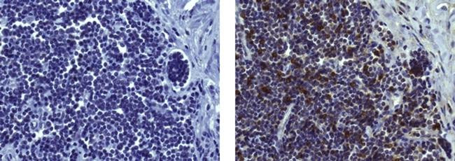 Mouse IgG (H+L) Secondary Antibody in Immunohistochemistry (Paraffin) (IHC (P))