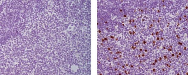 Mouse IgG (H+L) Secondary Antibody in Immunohistochemistry (Paraffin) (IHC (P))