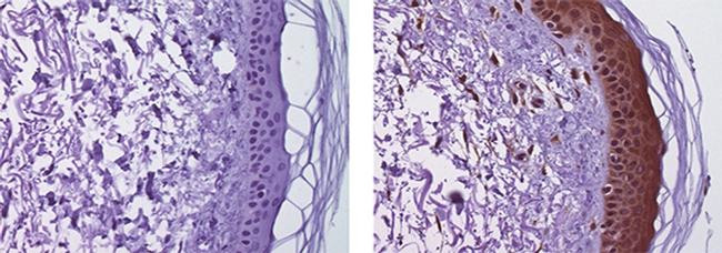 Mouse IgG (H+L) Secondary Antibody in Immunohistochemistry (Paraffin) (IHC (P))