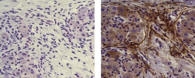 Mouse IgG (H+L) Secondary Antibody in Immunohistochemistry (Paraffin) (IHC (P))