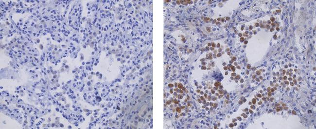 Mouse IgG (H+L) Secondary Antibody in Immunohistochemistry (Paraffin) (IHC (P))