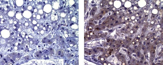 Mouse IgG (H+L) Secondary Antibody in Immunohistochemistry (Paraffin) (IHC (P))