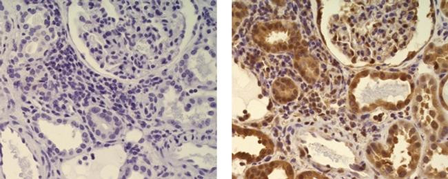 Mouse IgG (H+L) Secondary Antibody in Immunohistochemistry (Paraffin) (IHC (P))