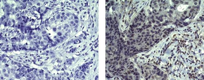 Mouse IgG (H+L) Secondary Antibody in Immunohistochemistry (Paraffin) (IHC (P))