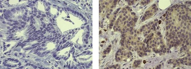 Mouse IgG (H+L) Secondary Antibody in Immunohistochemistry (Paraffin) (IHC (P))