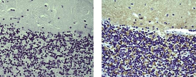 Mouse IgG (H+L) Secondary Antibody in Immunohistochemistry (Paraffin) (IHC (P))