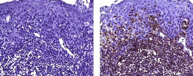 Mouse IgG (H+L) Secondary Antibody in Immunohistochemistry (Paraffin) (IHC (P))