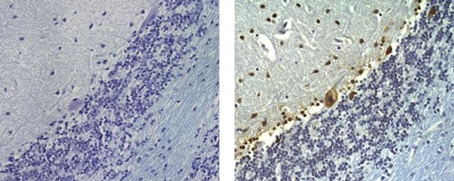 Mouse IgG (H+L) Secondary Antibody in Immunohistochemistry (Paraffin) (IHC (P))