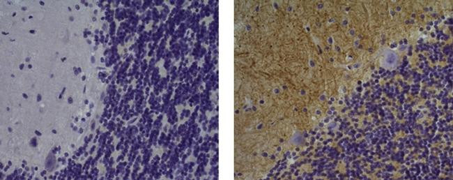 Mouse IgG (H+L) Secondary Antibody in Immunohistochemistry (Paraffin) (IHC (P))