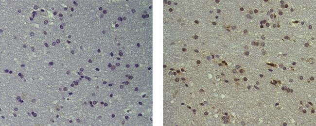 Mouse IgG (H+L) Secondary Antibody in Immunohistochemistry (Paraffin) (IHC (P))