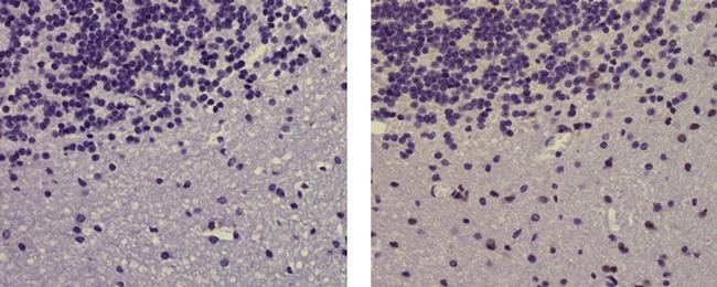 Mouse IgG (H+L) Secondary Antibody in Immunohistochemistry (Paraffin) (IHC (P))