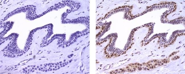 Mouse IgG (H+L) Secondary Antibody in Immunohistochemistry (Paraffin) (IHC (P))