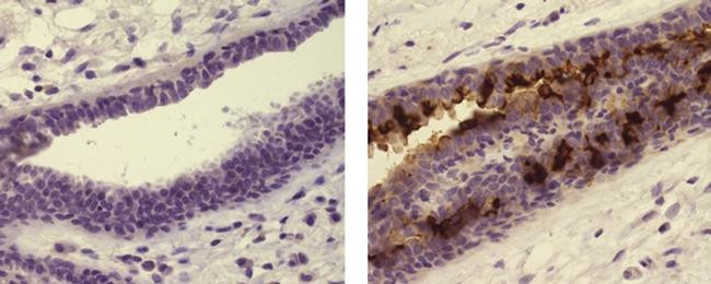 Mouse IgG (H+L) Secondary Antibody in Immunohistochemistry (Paraffin) (IHC (P))