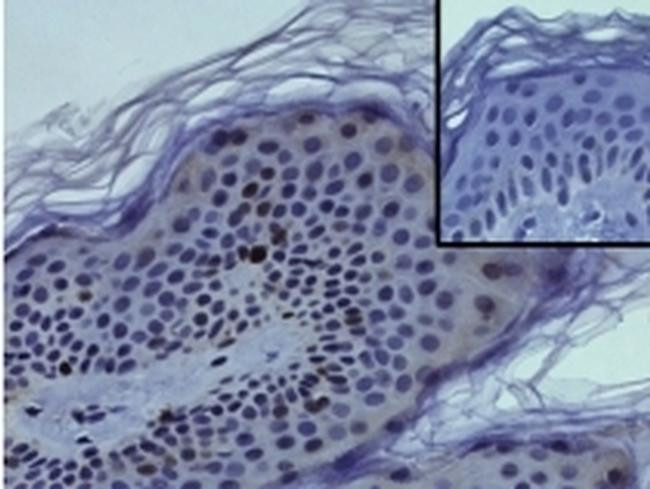 Mouse IgG (H+L) Secondary Antibody in Immunohistochemistry (Paraffin) (IHC (P))