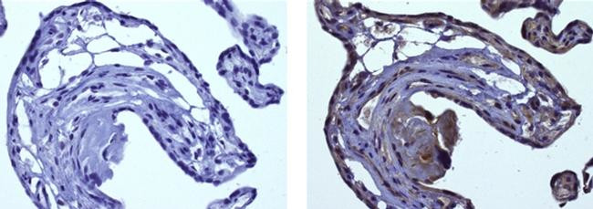 Mouse IgG (H+L) Secondary Antibody in Immunohistochemistry (Paraffin) (IHC (P))