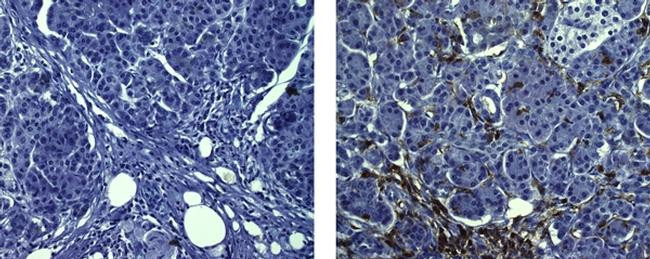 Mouse IgG (H+L) Secondary Antibody in Immunohistochemistry (Paraffin) (IHC (P))