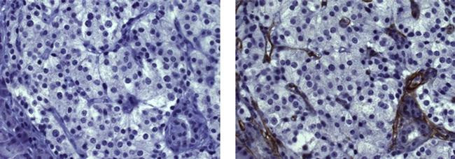 Mouse IgG (H+L) Secondary Antibody in Immunohistochemistry (Paraffin) (IHC (P))