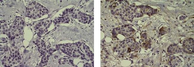 Mouse IgG (H+L) Secondary Antibody in Immunohistochemistry (Paraffin) (IHC (P))