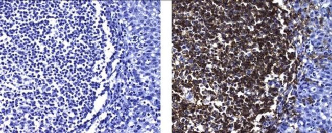 Mouse IgG2a Secondary Antibody in Immunohistochemistry (Paraffin) (IHC (P))