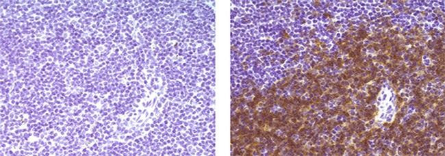 Rat IgG1 kappa Isotype Control in Immunohistochemistry (Paraffin) (IHC (P))