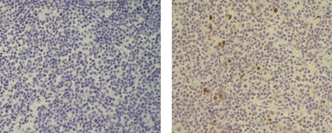 Rat IgG2a kappa Isotype Control in Immunohistochemistry (Paraffin) (IHC (P))