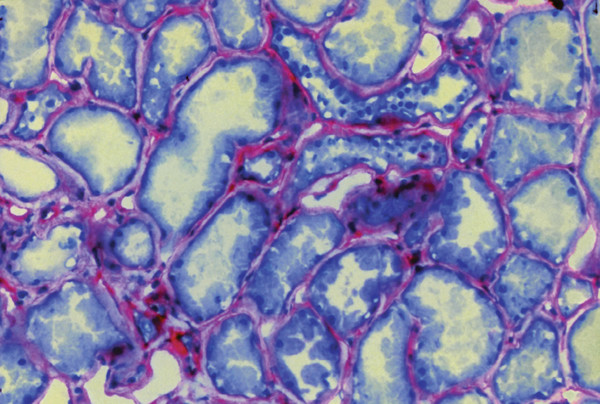 Perlecan Antibody in Immunohistochemistry (IHC)