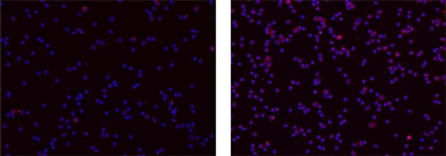 Mouse IgG1 kappa Isotype Control in Immunocytochemistry (ICC/IF)