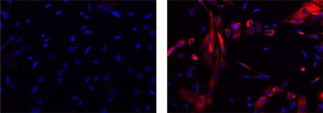 Mouse IgG1 kappa Isotype Control in Immunocytochemistry (ICC/IF)