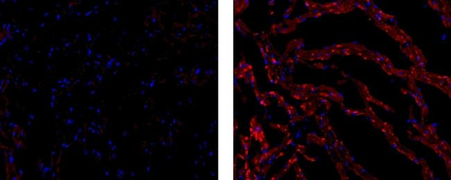 Mouse IgG1 kappa Isotype Control in Immunohistochemistry (Frozen) (IHC (F))