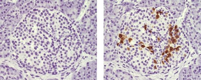 Mouse IgG1 kappa Isotype Control in Immunohistochemistry (Paraffin) (IHC (P))